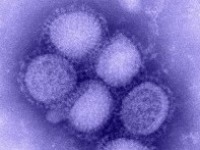 Weiterer best�tigter Fall der neuen Influenza in Brandenburg