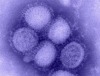 Weiterer bestätigter Fall der neuen Influenza in Brandenburg