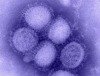 Weiterer bestätigter Fall der neuen Influenza in Brandenburg